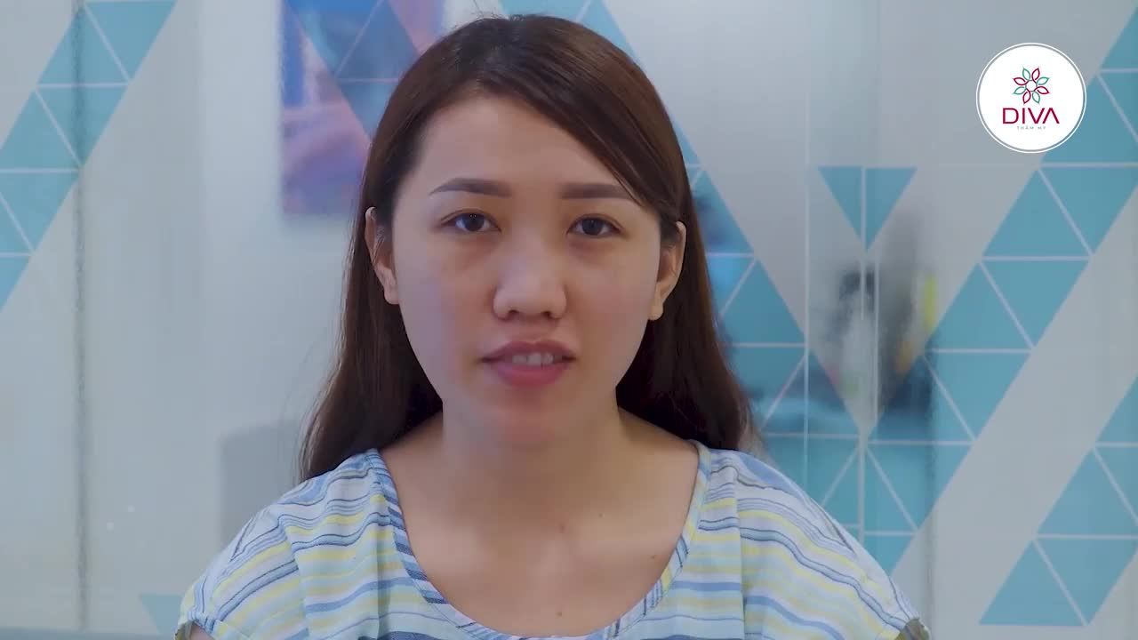SAU LẤY MỠ MÍ DƯỚI, NÂNG MŨI 3 TUẦN KẾT QUẢ NHƯ THẾ NÀO?