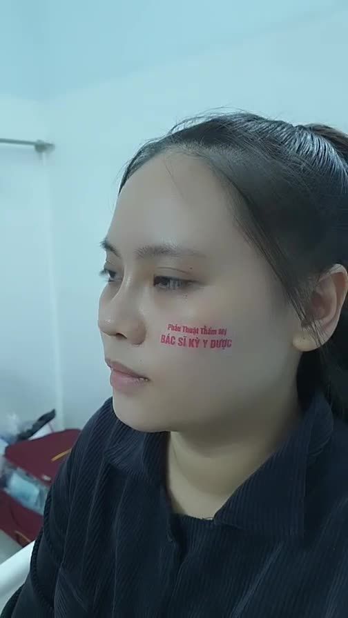 Cần Truyền Động Lực? Ngắm Liền Chiếc Mũi “Cực Phẩm”