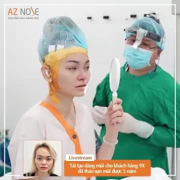 Mũi từng bị v.iêm và đã tháo sụn 5 năm được Bác sĩ CKI. Nguyễn Hoàng Nam khắc phục như thế nào?