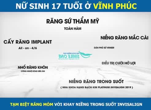 Bích Ngọc đã về đích xuất sắc trên hành trình niềng răng của mình! Với một nụ cười mới tự tin hơn, Smile One chúc em luôn may mắn và thành công hơn nhé!