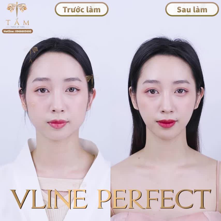 MỘT PHIÊN BẢN MỚI NÂNG CẤP HƠN - BẠN ĐÃ SẴN SÀNG?