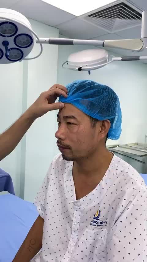 Hôm nay Bác sĩ và ekip tăng ca cuối tuần làm đẹp cho chị em cùng một khách hàng đặc biệt. Đó chính là Nam K.H 45 tuổi có sẹo xấu ở mặt do tai nạn giao thông.