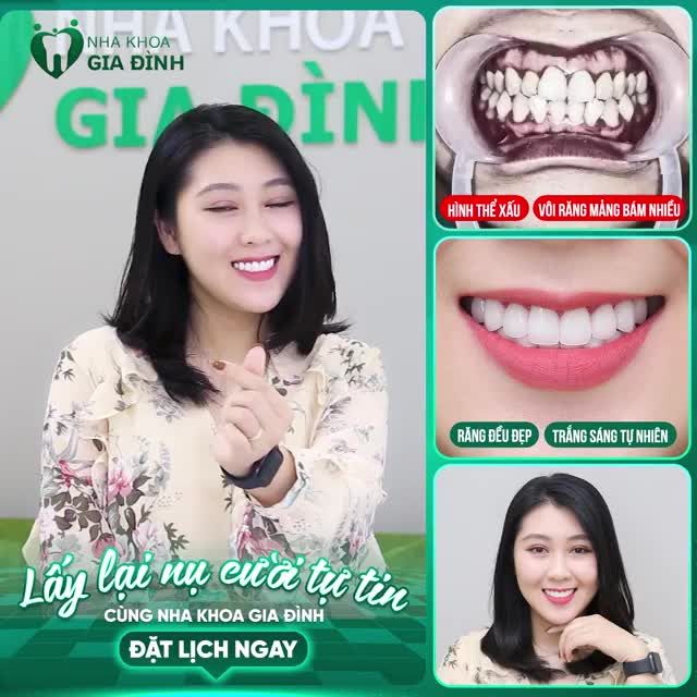 CẦN GÌ PHẢI NGƯỠNG MỘ NỤ CƯỜI CỦA NGƯỜI KHÁC, BẠN HOÀN TOÀN CÓ THỂ CÓ ĐƯỢC NÓ CƠ MÀ