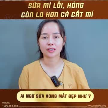 Đôi mắt đính cơ nâng mi sâu, nếp mí không cân đối, mí to mí nhỏ sau khi cắt mí tại cơ sở thẩm mỹ kém uy tín khiến vị khách hàng ám ảnh, sợ hãi, mất niềm tin vào thẩm mỹ!