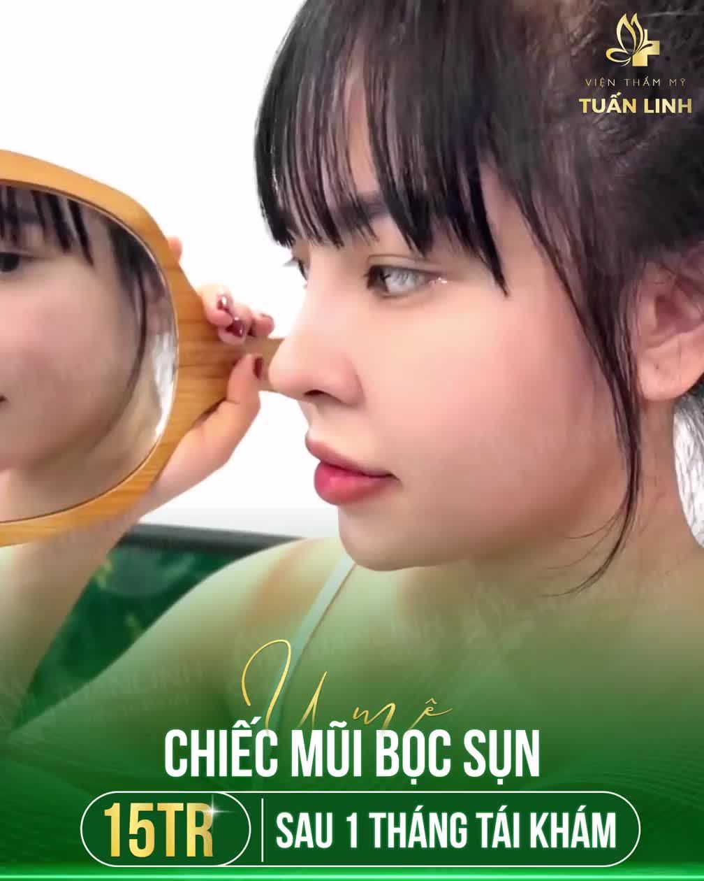 U MÊ CHIẾC MŨI BỌC SỤN 15 TRIỆU NÀY QUÁ ĐI!!!