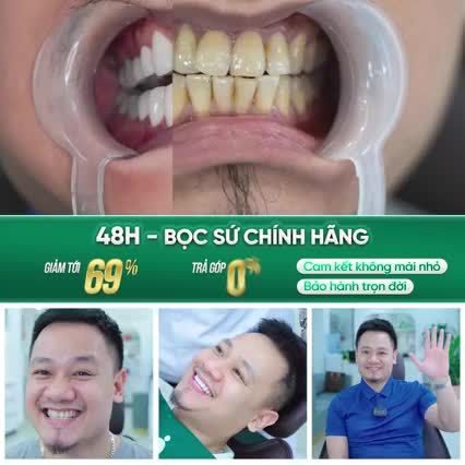 48 GIỜ - BỌC SỨ CHÍNH HÃNG, ĐẸP KHÔNG TÌ VẾT