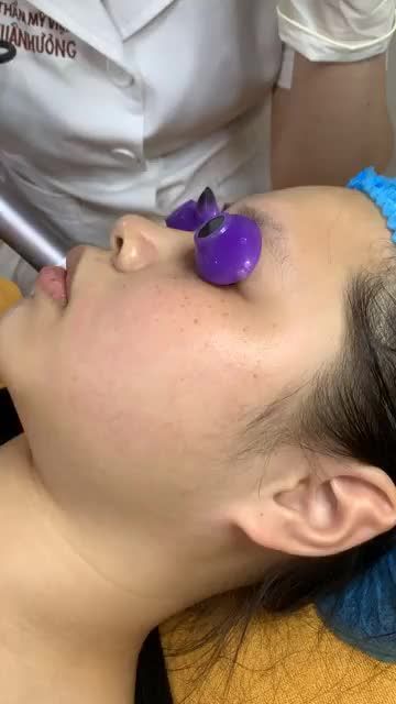Điều trị tàn nhang chỉ 1 lần duy nhất