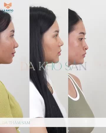 BOOSTER DETOX  "GIẢI CỨU" LÀN DA VỚI DEAL SIÊU SỐC chỉ 790K