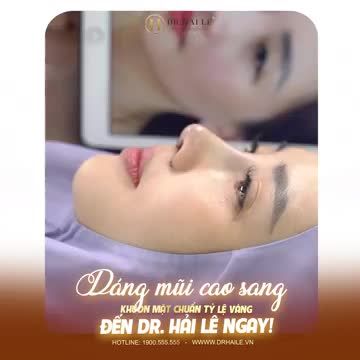 Gương mặt đạt chuẩn tỷ lệ vàng - Điều mà bất cứ chị em nào cũng ao ước!