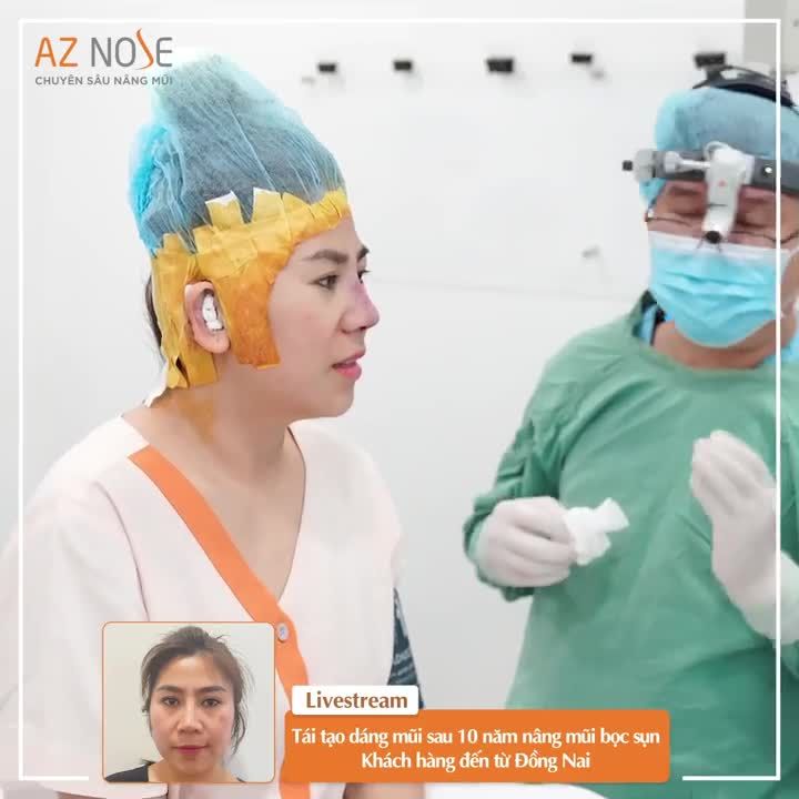 Tái tạo dáng mũi sau 10 năm nâng mũi bọc sụn cho khách hàng đến từ Đồng Nai