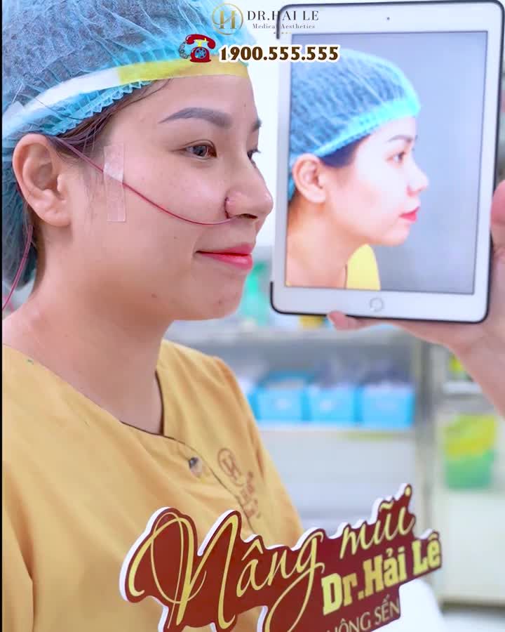 Nâng mũi Dr Hải Lê- Mũi đẹp tinh tế chỉ sau 60 phút
