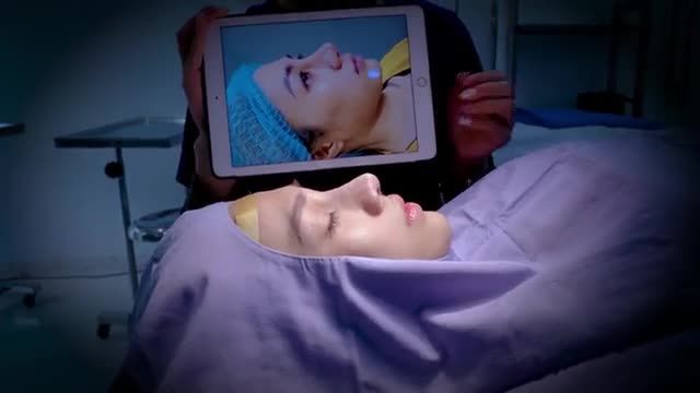 Chiêm ngưỡng ngay "tác phẩm" sau  khi nâng mũi Mediform ở góc độ nằm nghiêng của chị khách hàng dưới đây để cùng thấy được sự thây đổi của khách hàng