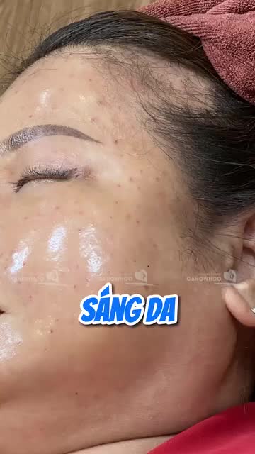 PRP - PHAO CỨU SINH TỐI ƯU CHO LÀN DA CỦA BẠN