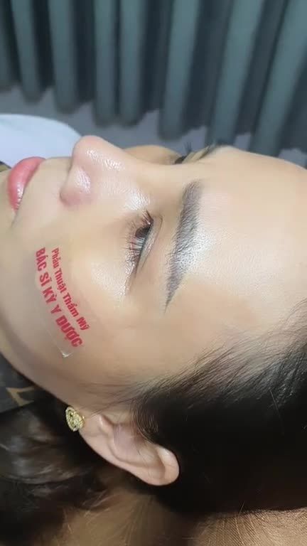 Tự tin khác biệt với dáng mũi ALINE cao thanh tú cùng với 3 tiêu chí quan trọng: - Chính tay Bác sĩ Kỳ Y Dược thực hiện. - Thiết kế dáng mũi hài hoà, cân đối gương mặt. - Chế độ bảo hành vĩnh viễn.