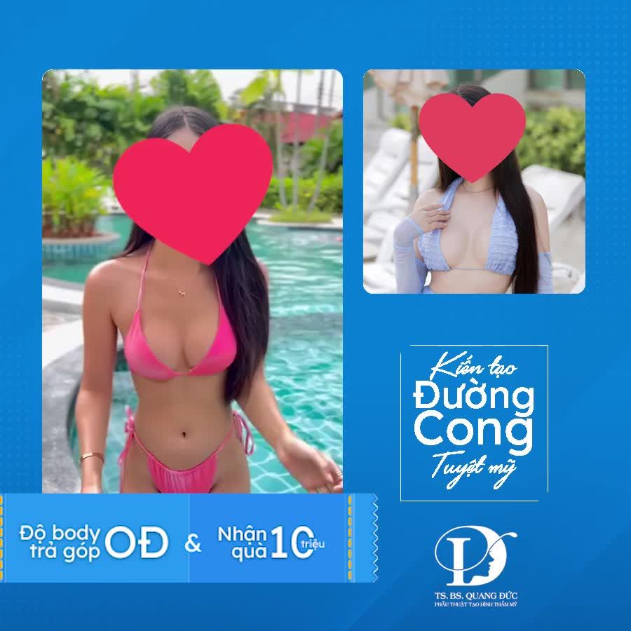 COMBO BỤNG NGỰC CHỈ 0Đ - NHẬN ƯU ĐÃI HOT