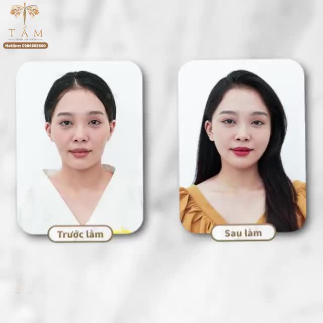 Combo Filler sẽ thay đổi diện mạo như thế nào?
