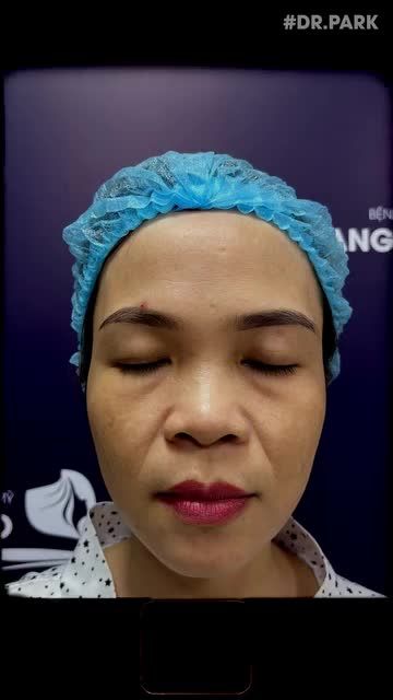 VÌ SAO NÊN CHỌN BỆNH VIÊN GANGWHOO ĐỂ BẤM MÍ VĨNH VIỄN?