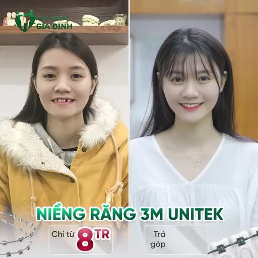 CHÀO TÂN SINH VIÊN – NIỀNG RĂNG ƯU ĐÃI CHỈ TỪ 8 TRIỆU