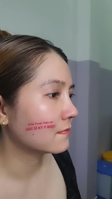 Đối với tất cả khách hàng, khi đến với Bác Sĩ Kỳ Y Dược đều sẽ được chăm sóc kỹ lưỡng từ trước, trong cho đến sau khi phẫu thuật.