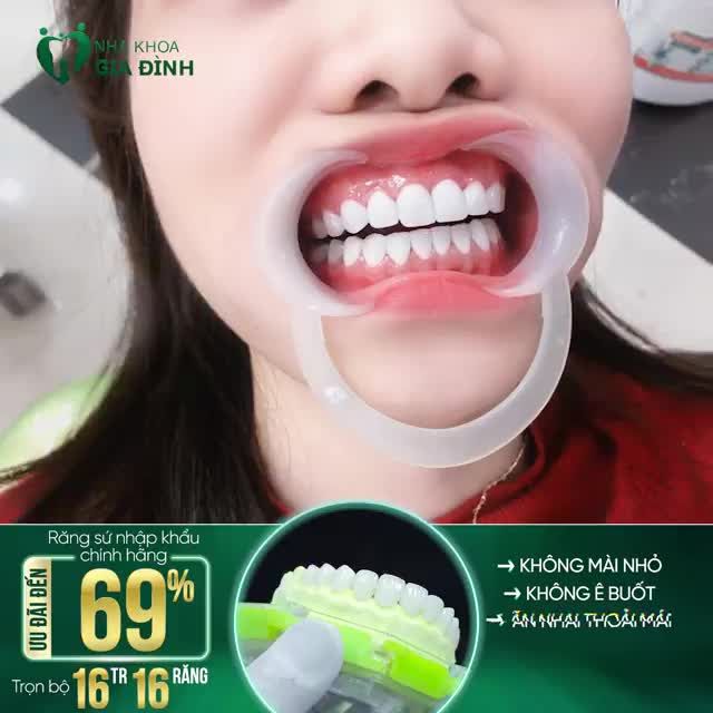 RĂNG ĐẸP, LỢI HỒNG SĂN CHẮC THẾ NÀY BẠN BIẾT PHẢI LÀM GÌ RỒI ĐÚNG KHÔNG?