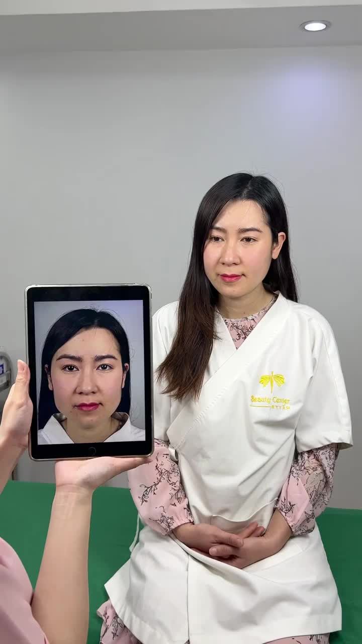 Chị Hoa trở lại Tấm để thực hiện kiểm tra tình trạng mặt hiện tại của mình sau 2 tháng sử dụng dịch vụ