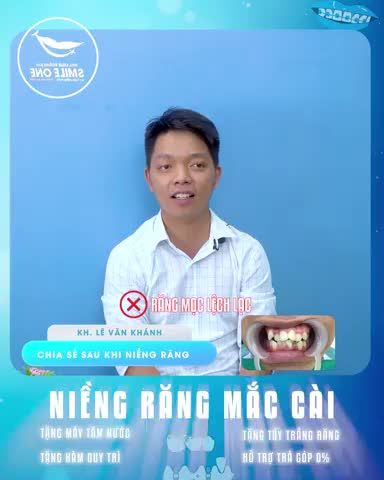 Đi phỏng vấn xin việc nhưng bị “ngó lơ” chỉ vì ngoại hình có một hàm răng “siêu khấp khểnh, lệch lạc và hô, bạn có tin được không?