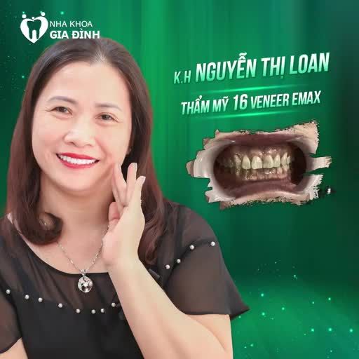 TOP 5 KHÁCH HÀNG RẠNG NGỜI SAU KHI THẨM MỸ RĂNG SỨ
