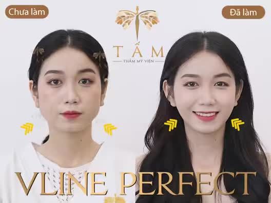 THON GỌN MẶT CHỈ 1 LIỆU TRÌNH DUY NHẤT: