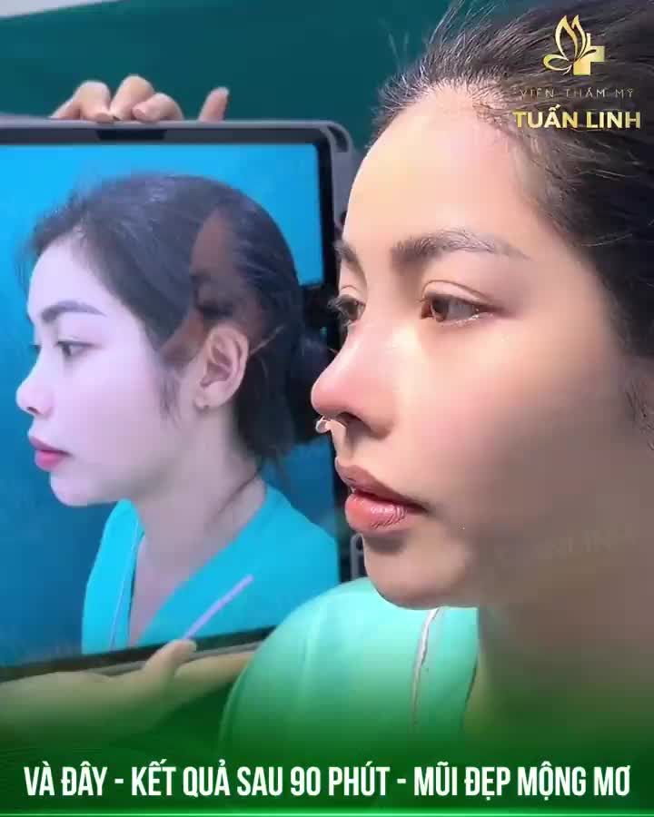 Khách hàng nói ''BÁC SĨ CỨ NÂNG CHO EM ĐẸP LÀ ĐƯỢC?'' - Nghe thì đơn giản mà thực ra cũng không dễ đâu ạ!!