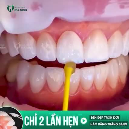 TRẮNG SÁNG - ​​​​​​​BÓNG TRONG - TINH TẾ NHƯ RĂNG THẬT CHỈ CÓ TẠI NHA KHOA GIA ĐÌNH