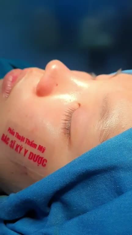 Phần thưởng cho sự nỗ lực và cố gắng suốt những năm học. Mẹ bạn khách đã thưởng cho bạn khách 1 chiếc mũi hết sức xinh đẹp.