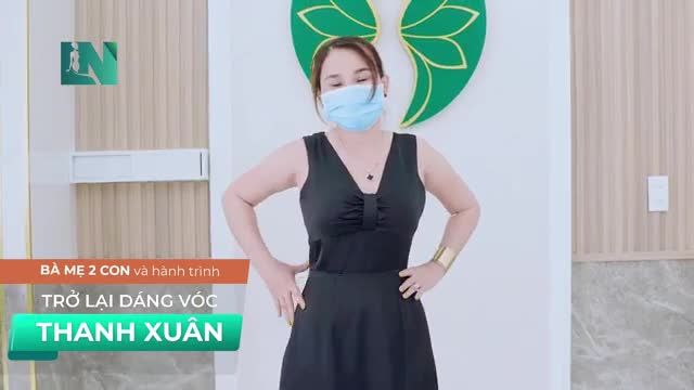 Chị Thường – đến từ Bình Phước, Khách hàng thực hiện hút mỡ tạo dáng thẩm mỹ vùng bụng cách đây 1 năm trước quay trở lại Bệnh viện để giảm mỡ thêm