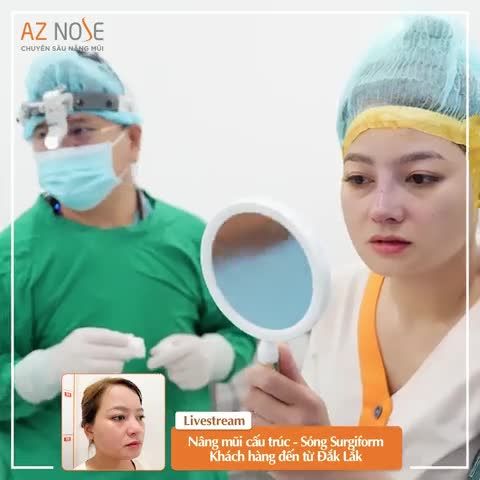 Sóng mũi to - đầu mũi t.o được cải thiện thế nào sau khi nâng mũi cấu trúc?