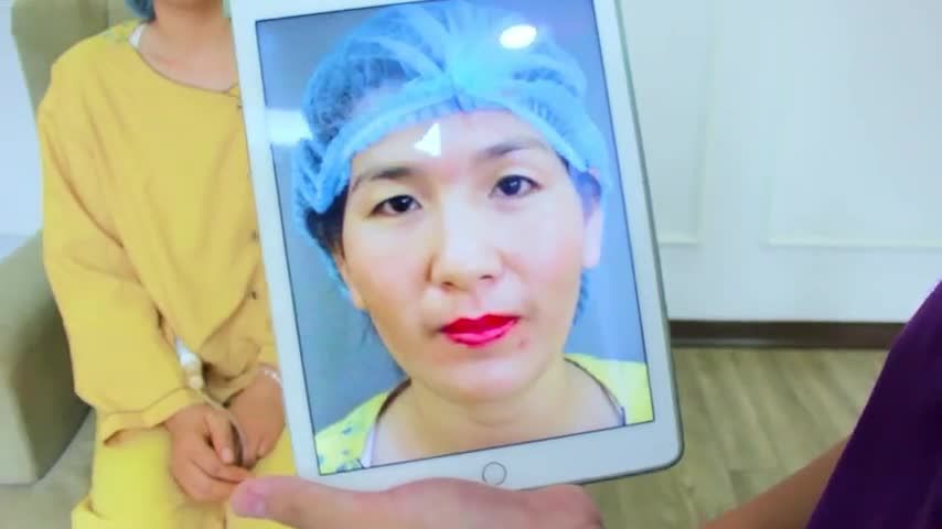Trẻ ra 5-10 tuổi chỉ nhờ đôi mắt sau cắt mí bạn có tin? Theo dõi ngay