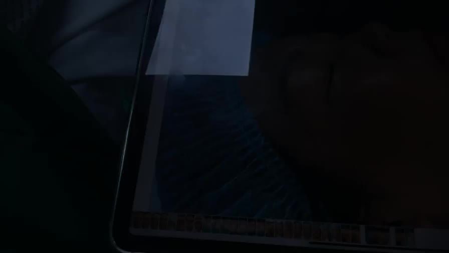 Nâng mũi cấu trúc surgiform với Dr Vương