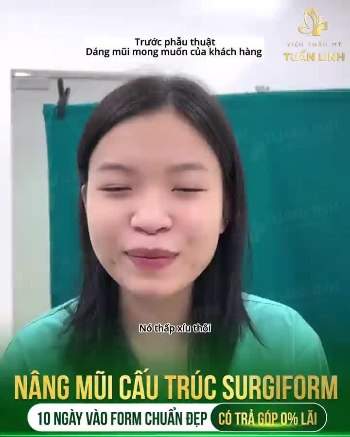 Nâng mũi 10 ngày vào form chuẩn đẹp - Liệu có đúng sự thật