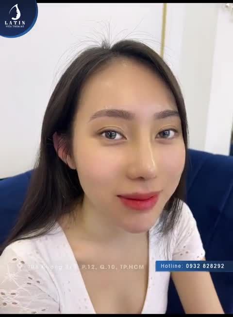 Tự tin tỏa sáng cùng dáng mũi mới tại Latin