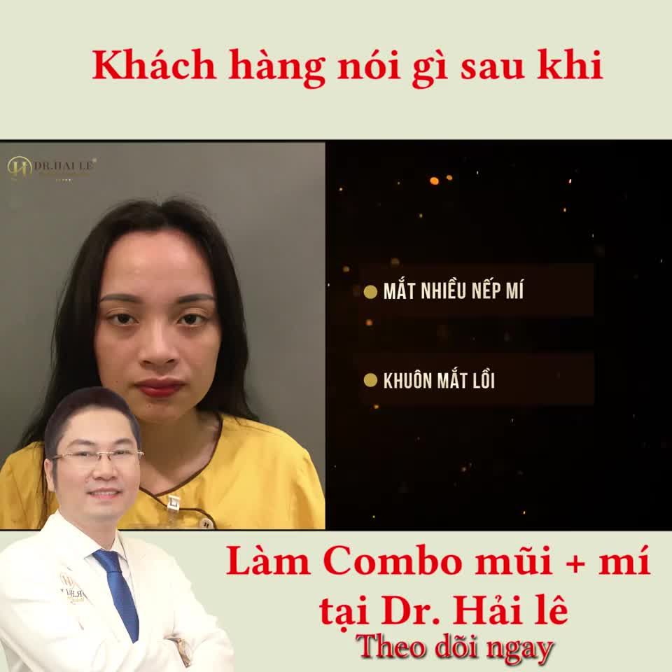 Khách hàng nói gì sau Nâng mũi tại Dr.Hải Lê? Theo dõi ngay