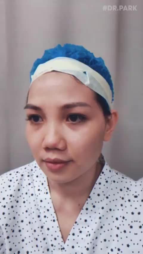 NÂNG MŨI HÀN QUỐC DÀNH CHO AI?