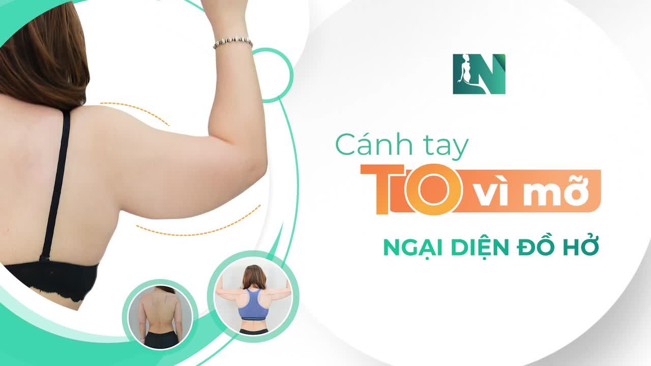 Với giải pháp hút mỡ tạo dáng thẩm mỹ được thực hiện ngay tại Bệnh viện với quy trình chuẩn: đẹp và an toàn bởi Ekip Bác sĩ Lương Ngọc.