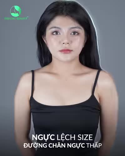 NÂNG NGỰC TC 39TR - BÙNG NỔ ƯU ĐÃI SINH NHẬT 27 NĂM