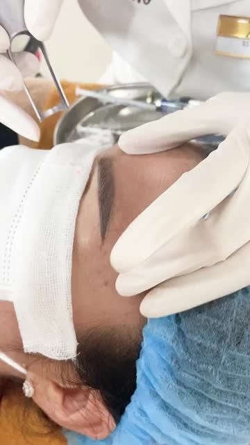 Cận cảnh hút mực xăm mày khác biệt rõ ngay sau lần đầu tiên