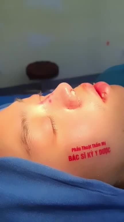 Hóa nam thần tại Bác Sĩ Kỳ Y Dược