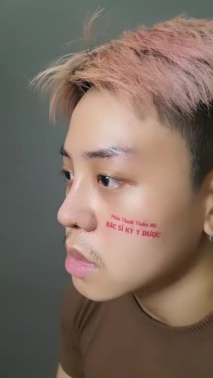 NÂNG MŨI CẤU TRÚC - HOÀN THIỆN VẺ ĐẸP NAM TÍNH