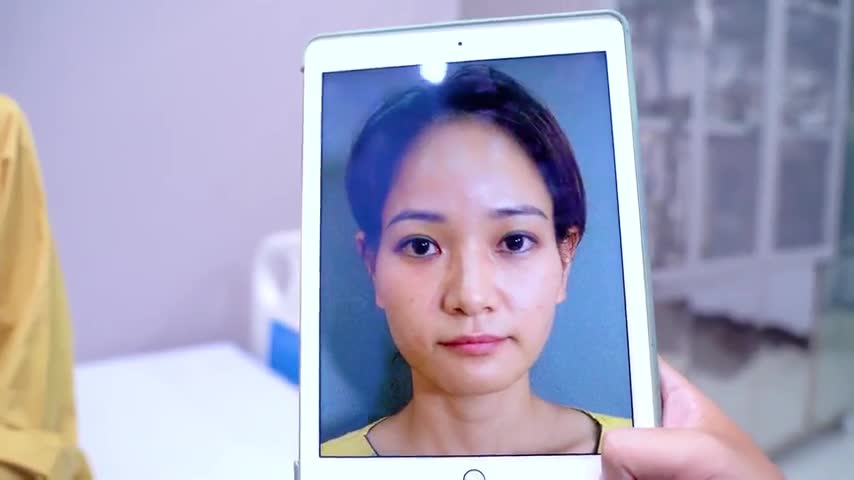 Gò má cao, thái dương hóp được khắc phục như thế nào sau khi đến Dr.Hải Lê? Theo dõi ngay