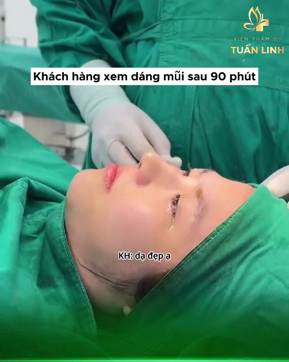 Cải thiện hoàn toàn tình trạng mũi ngắn hếch nhiều sau 90 phút phẫu thuật!!