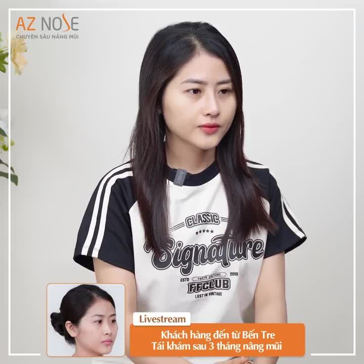 Khách hàng đến từ Bến Tre tái khám sau 3 tháng nâng mũi Thực hiện bởi bác sĩ CKI. Đinh Xuân Sơn Tùng.