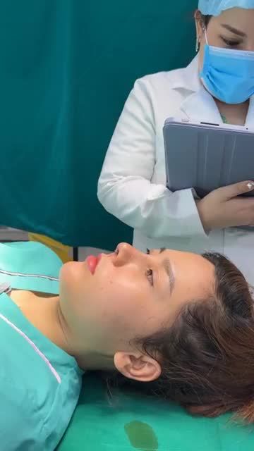 Case mũi cấu trúc sửa lại vừa hoàn thành