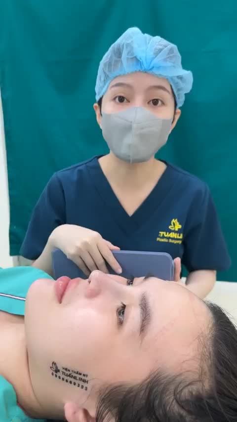 Case mũi cấu trúc vừa hoàn thành