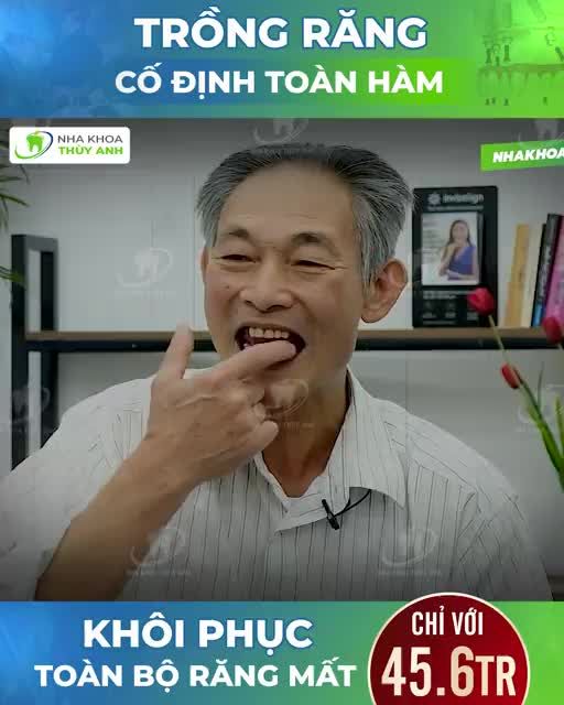 TRỒNG 4 TRỤ IMPLANT KHÔI PHỤC TOÀN BỘ HÀM RĂNG MẤT
